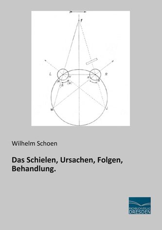 Das Schielen, Ursachen, Folgen, Behandlung.
