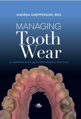 Managing Tooth Wear