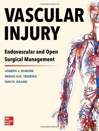 Vascular Injury