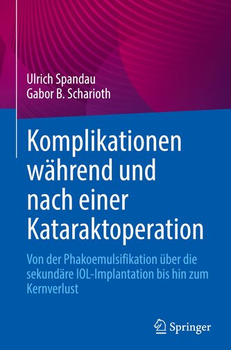 Komplikationen während und nach einer Kataraktoperation
