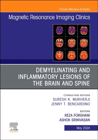 Demyelinating and Inflammatory Lesions of the Brain and Spine, An Issue of Magnetic Resonance Imaging Clinics of North A
