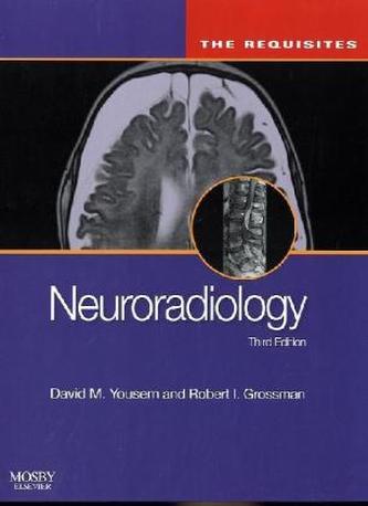 Neuroradiology: The Requisites