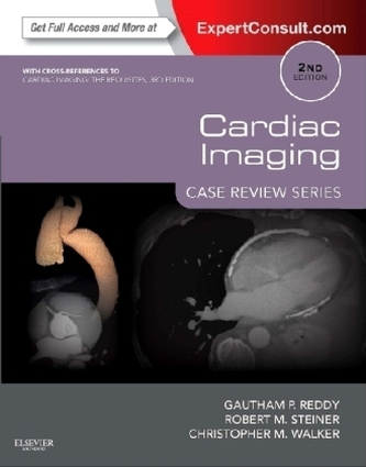 Cardiac Imaging