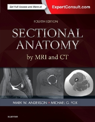 Sectional Anatomy by MRI and CT