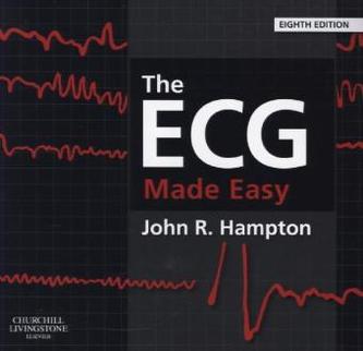 The ECG Made Easy