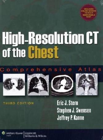 High-Resolution CT of the Chest