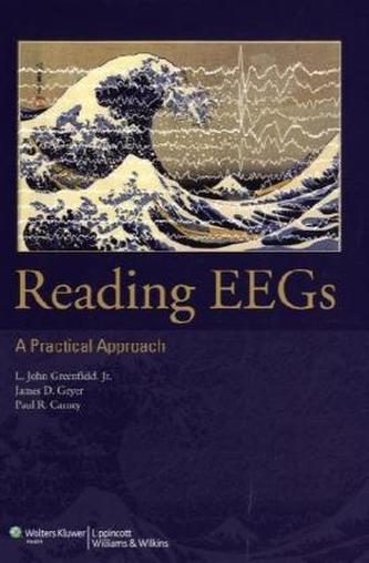 Reading EEGs