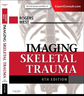 Imaging Skeletal Trauma