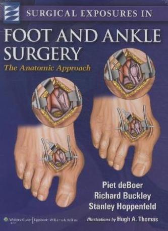 Surgical Exposures in Foot & Ankle Surgery
