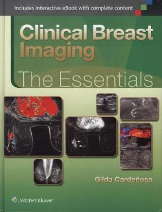 Clinical Breast Imaging