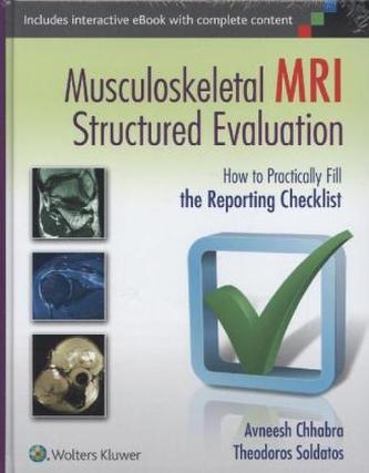 Musculoskeletal MRI Structured Evaluation