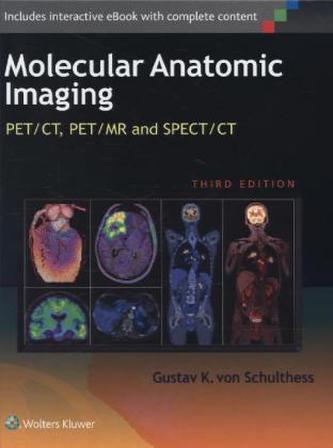 Clinical Molecular Anatomic Imaging