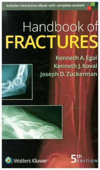 Handbook of Fractures