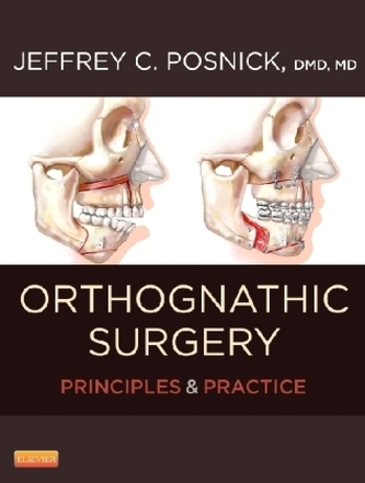 Orthognathic Surgery, 2 Vols.