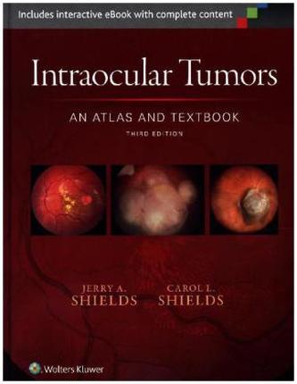 Intraocular Tumors: An Atlas and Textbook