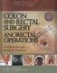 Colon and Rectal Surgery: Anorectal Operations