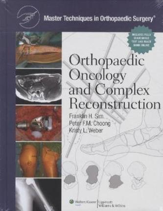 Orthopaedic Oncology and Complex Reconstruction