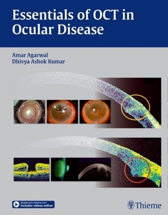 Essentials of OCT in Ocular Disease