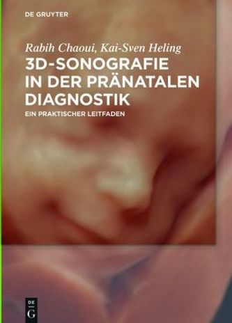 3D-Sonographie in der pränatalen Diagnostik