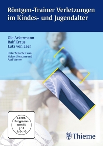 Röntgen-Trainer Verletzungen im Kindes- und Jugendalter, 1 DVD