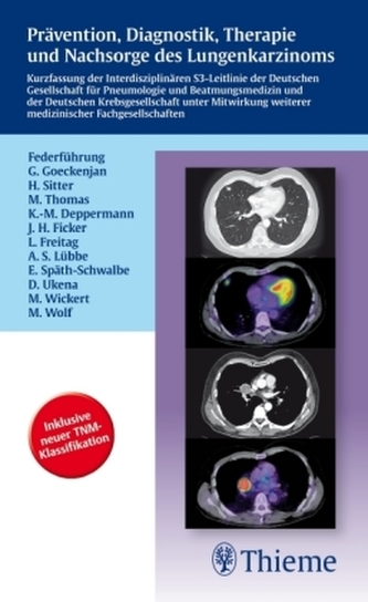 Prävention, Diagnostik, Therapie und Nachsorge des Lungenkarzinoms