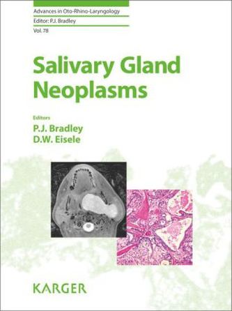 Salivary Gland Neoplasms
