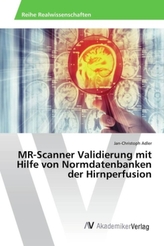 MR-Scanner Validierung mit Hilfe von Normdatenbanken der Hirnperfusion