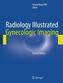 Radiology Illustrated Gynecologic Imaging