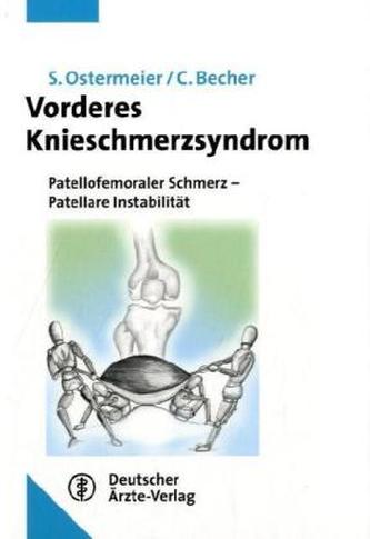 Vorderes Knieschmerzsyndrom