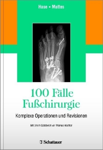 100 Fälle Fußchirurgie