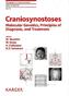Craniosynostoses