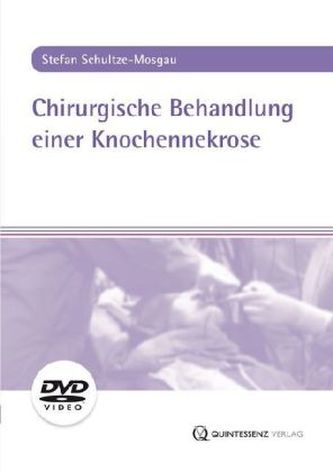 Chirurgische Behandlung einer Knochennekrose, 1 DVD