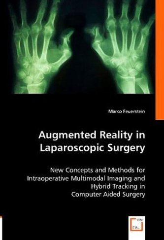 Augmented Reality in Laparoscopic Surgery