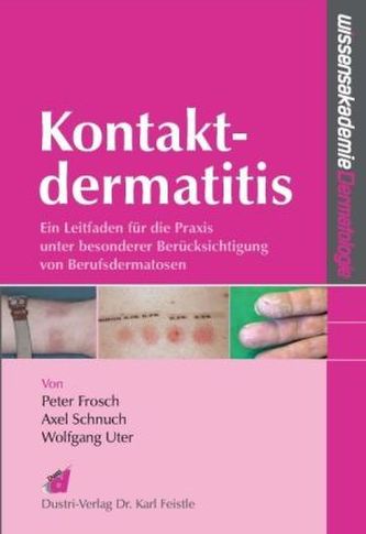 Kontaktdermatitis