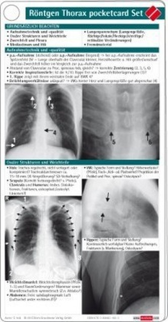 Röntgen Thorax pocketcard Set, Kartenfächer
