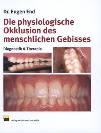 Die physiologische Okklusion des menschlichen Gebisses