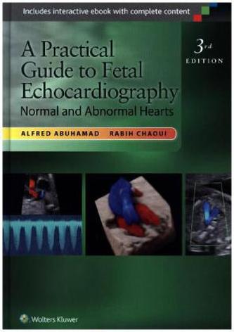A Practical Guide to Fetal Echocardiography