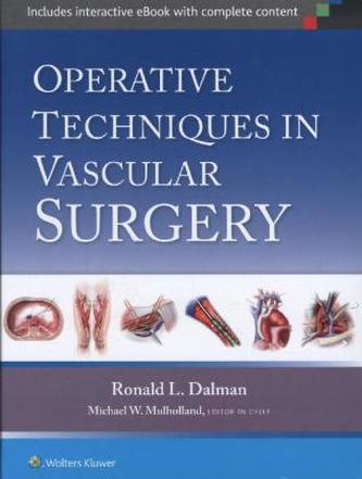 Operative Techniques in Vascular Surgery