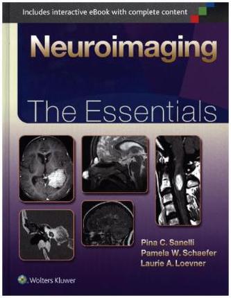 Neuroimaging