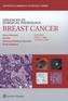 Advances in Surgical Pathology: Breast Cancer