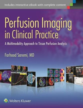 Perfusion Imaging in Clinical Practice
