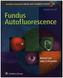 Fundus Autofluorescence