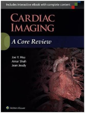 Cardiac Imaging: A Core Review