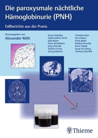 Die paroxysmale nächtliche Hämoglobinurie (PNH)