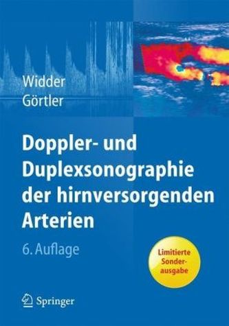 Doppler- und Duplexsonographie der hirnversorgenden Arterien