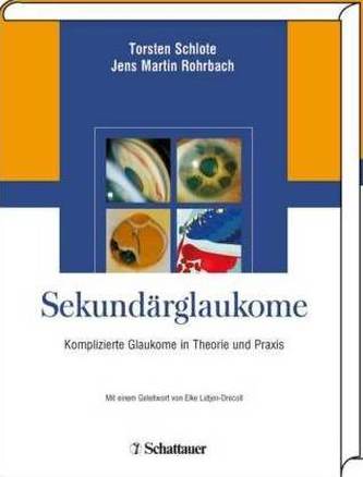 Sekundärglaukome