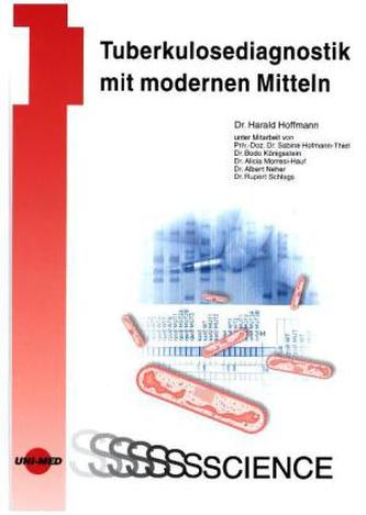 Tuberkulosediagnostik mit modernen Mitteln