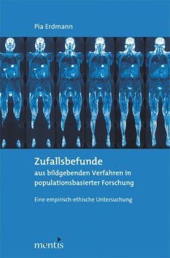 Zufallsbefunde aus bildgebenden Verfahren in populationsbasierter Forschung