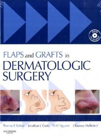 Flaps and Grafts in Dermatologic Surgery, w. DVD-ROM