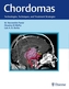 Chordomas